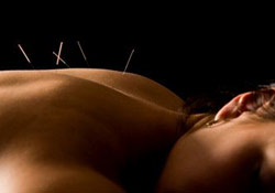 L'acupuncture, est-ce que ça marche ?