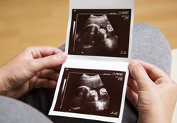 chographie de grossesse, femme enceinte, gyncologue